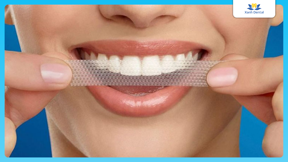 Tẩy trắng răng bằng miếng dán trắng răng