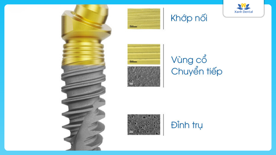 Cấu tạo trụ Implant ETK