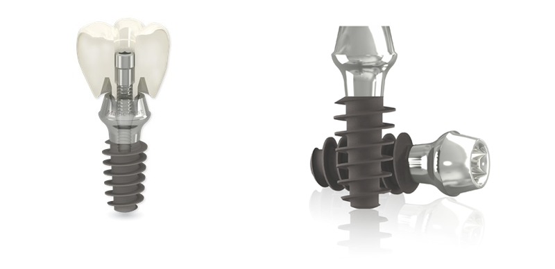 Mô cấu trụ implant IBS 