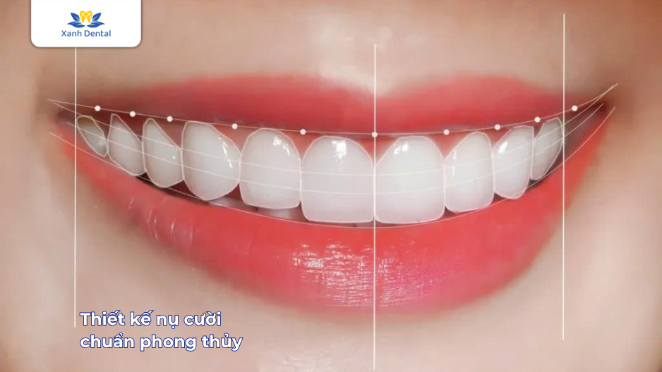 Thiết kế nụ cười chuẩn phong thủy