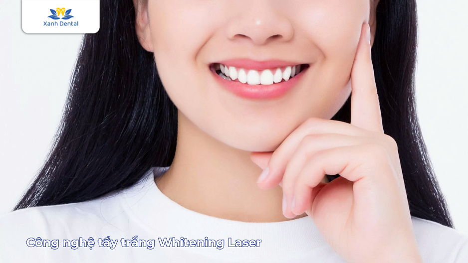 Công nghệ tẩy trắng Whitening Laser