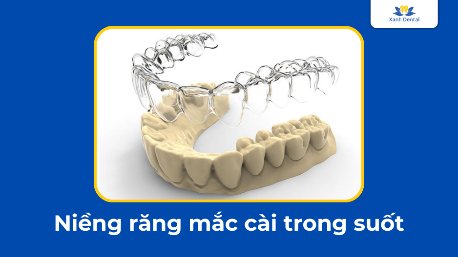 Niềng răng mắc cài trong suốt
