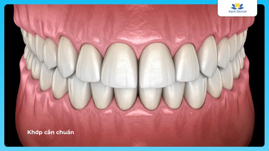 Khớp cắn chuẩn