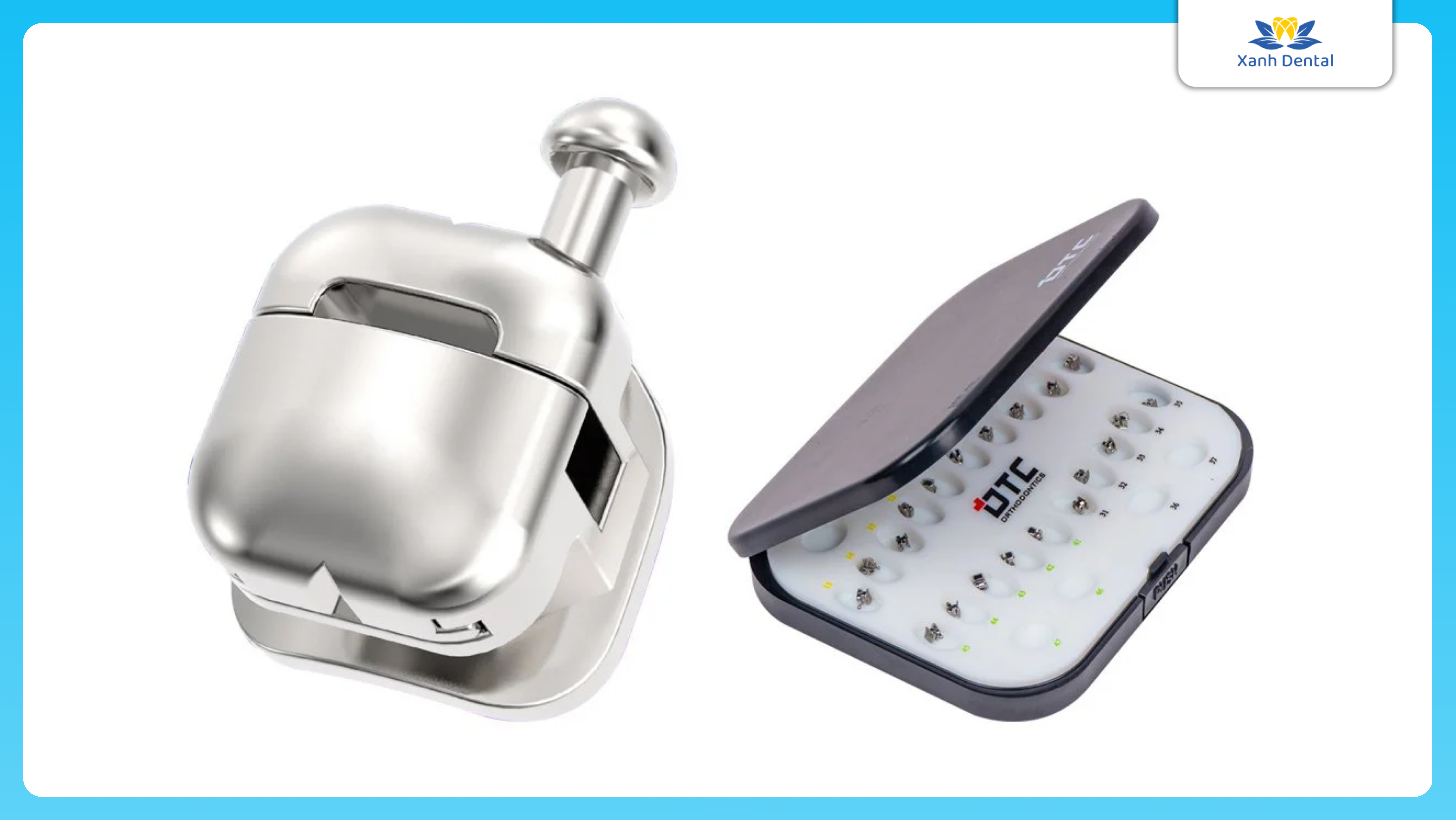 Mắc cài cánh cam niềng răng vượt trội