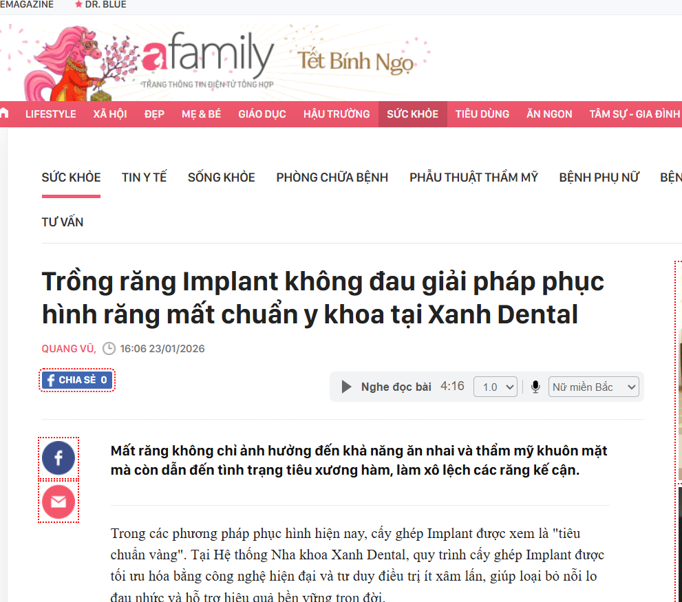 Trên tờ Afamily, giải pháp trồng răng Implant không đau tại Xanh Dental